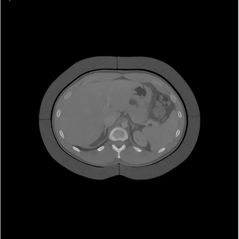 2.5cm Fat Ring For Abdomen Phantom
