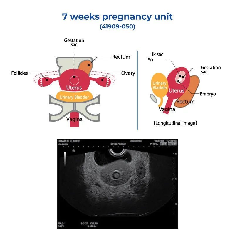 7 Weeks Pregnancy Unit