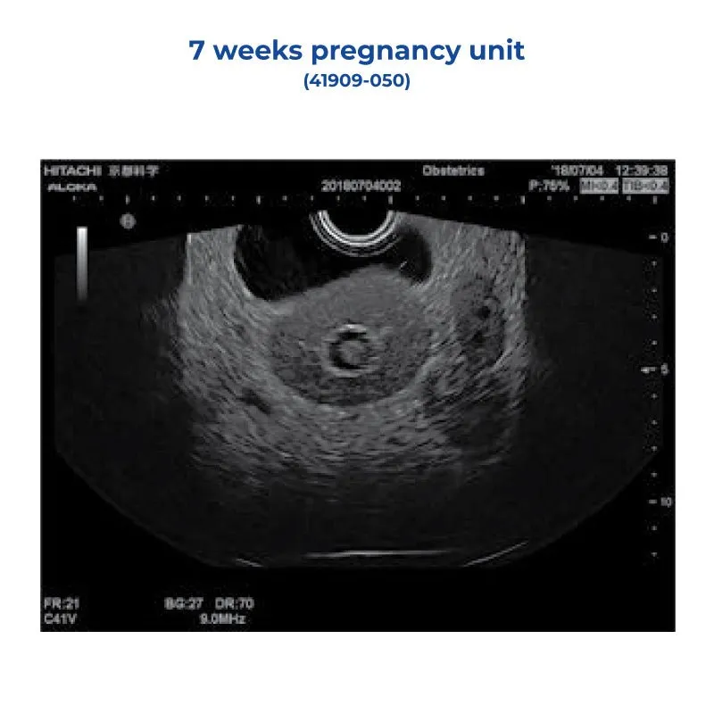 7 Weeks Pregnancy Unit