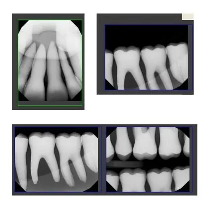 Adult X-Ray Dental Manikin