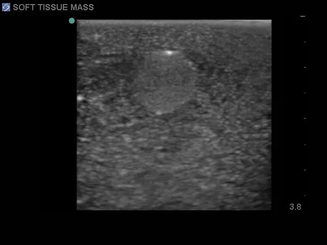 Biopsy and Elastography Ultrasound Training Model