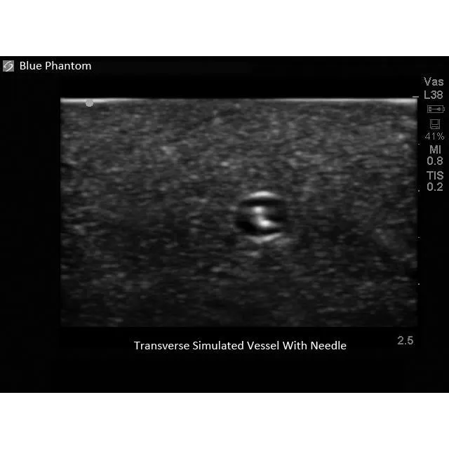 Branched 4 Vessel Ultrasound Training Block