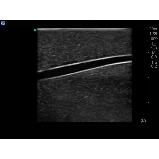 Branched 4 Vessel Ultrasound Training Block