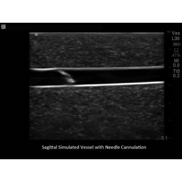 Branched 4 Vessel Ultrasound Training Block