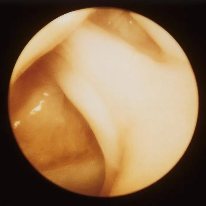 CLA Arthroscopy Model of the Knee-Joint