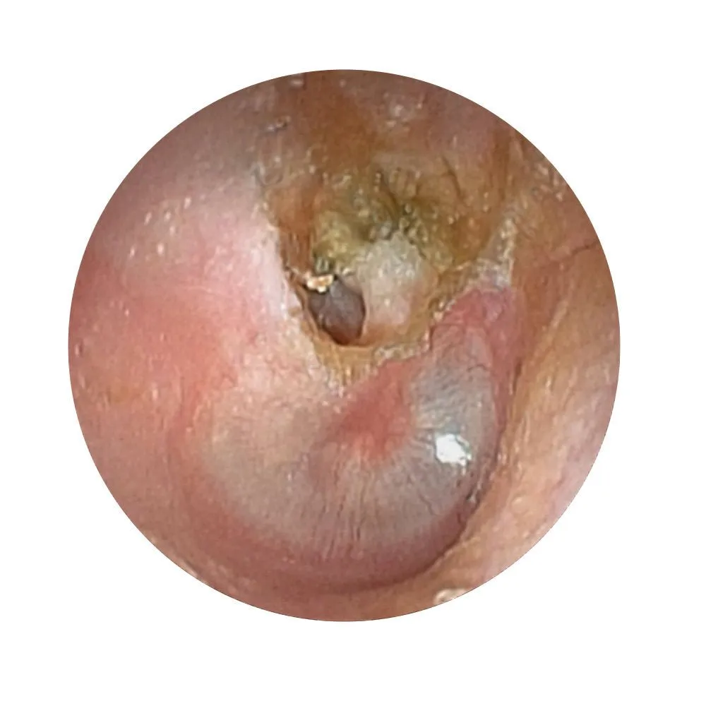 Ear Examination Simulator II
