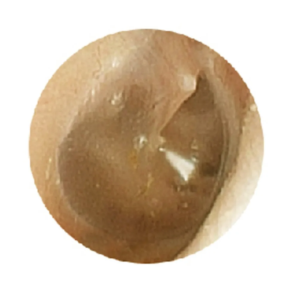 Ear Examination Simulator II
