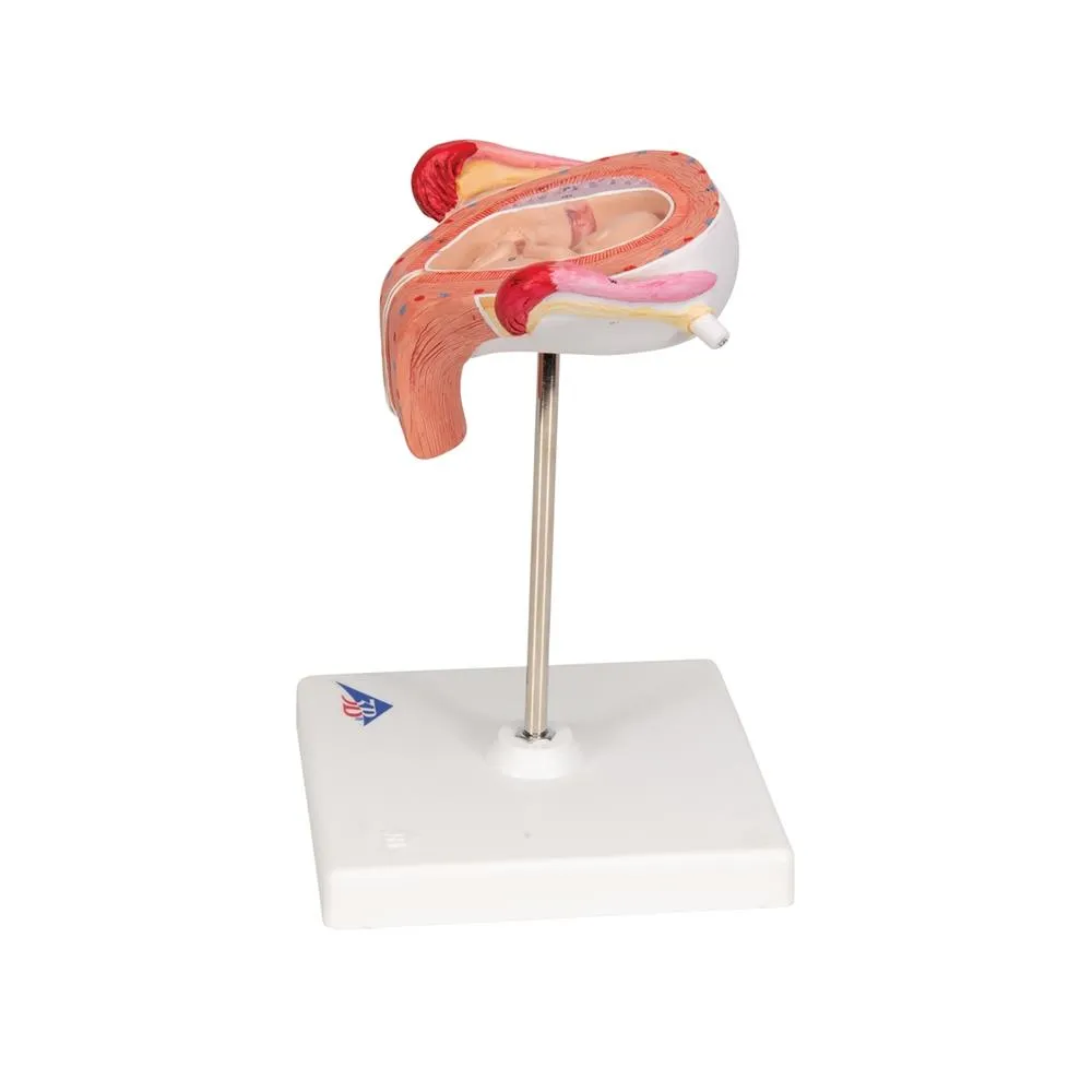 Fetus Model, 3 Month