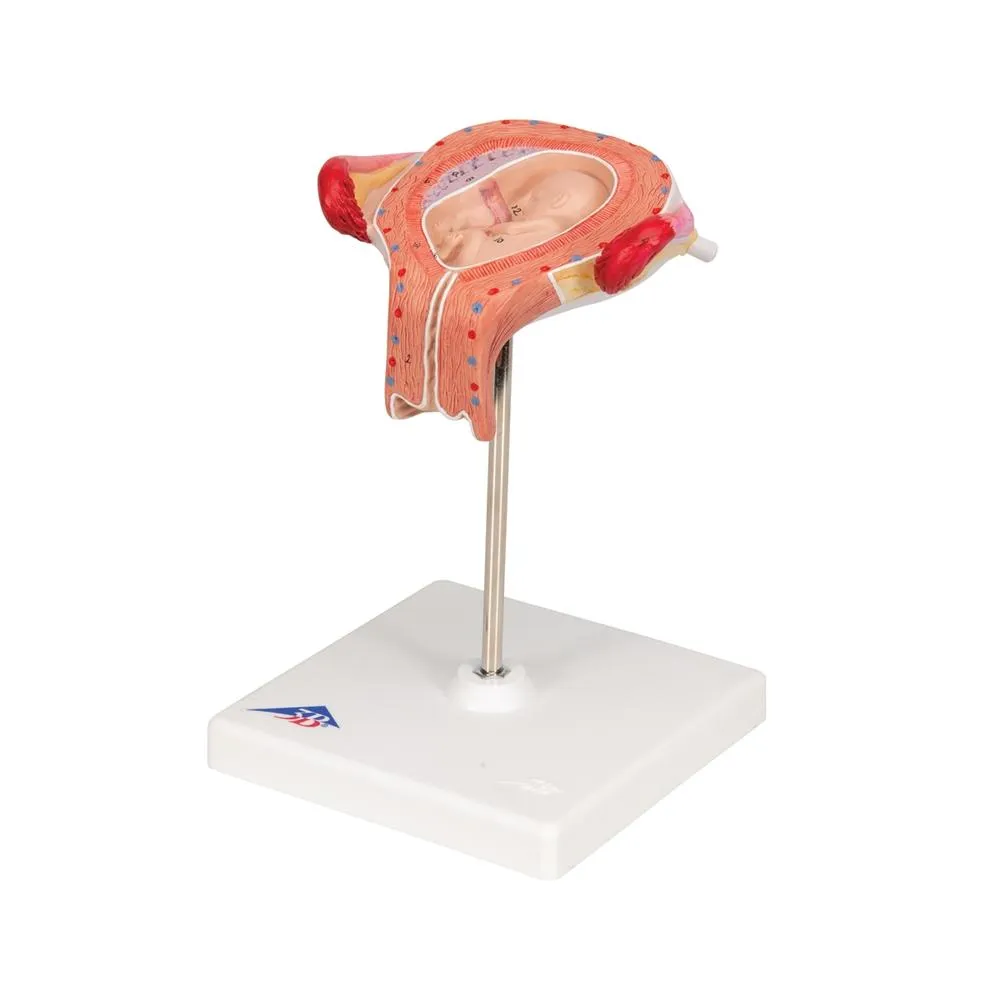 Fetus Model, 3 Month