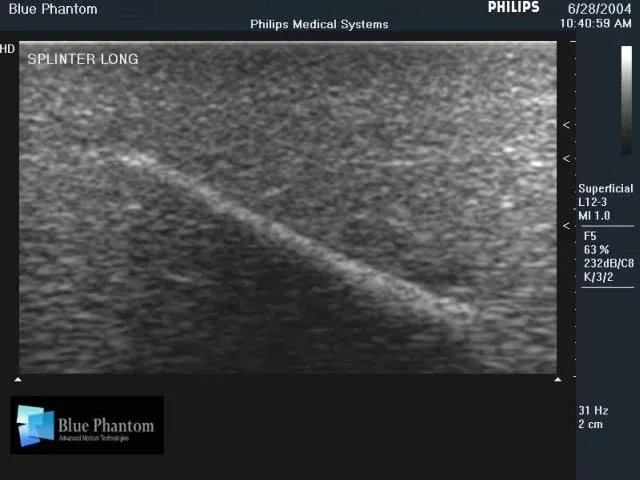 Foreign Body Identification Ultrasound Training