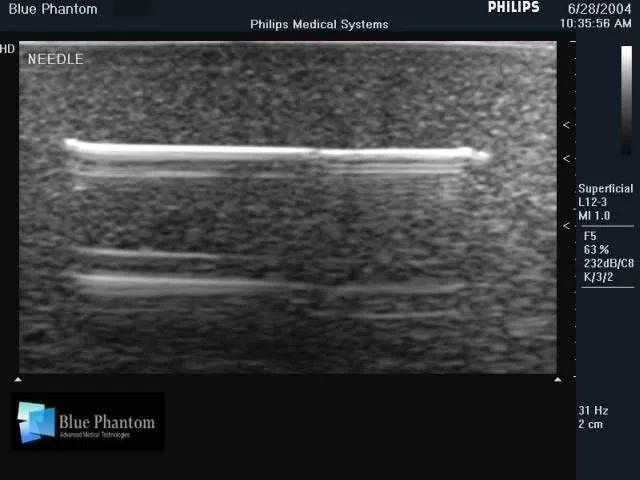 Foreign Body Identification Ultrasound Training