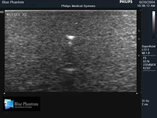 Foreign Body Identification Ultrasound Training