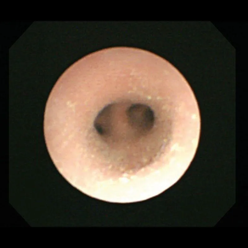 Koken Bronchoscopy Training Model