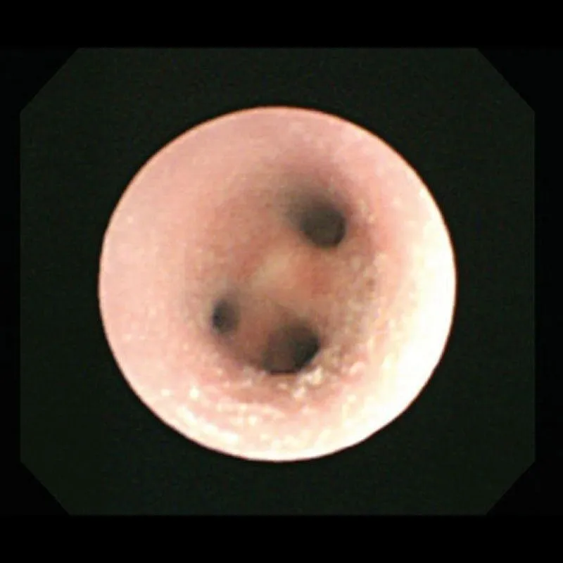 Koken Bronchoscopy Training Model