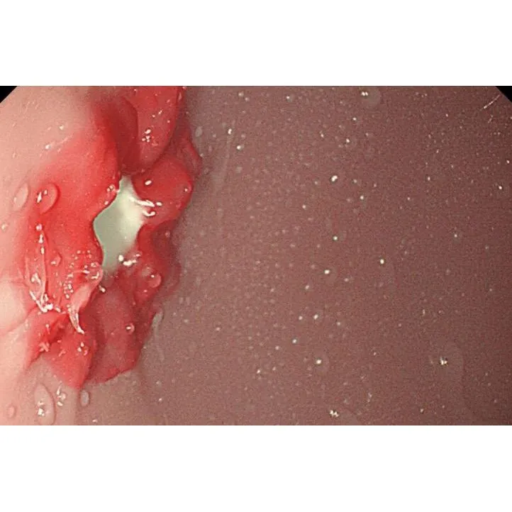 Koken EGD (Esophago-Gastro-Duodenoscopy) Simulator