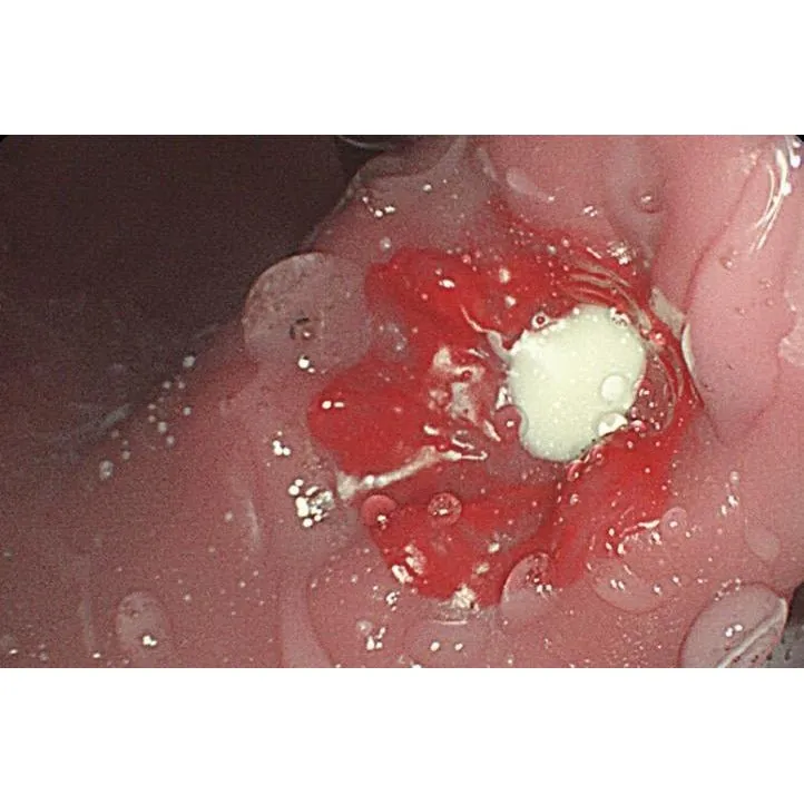 Koken EGD (Esophago-Gastro-Duodenoscopy) Simulator