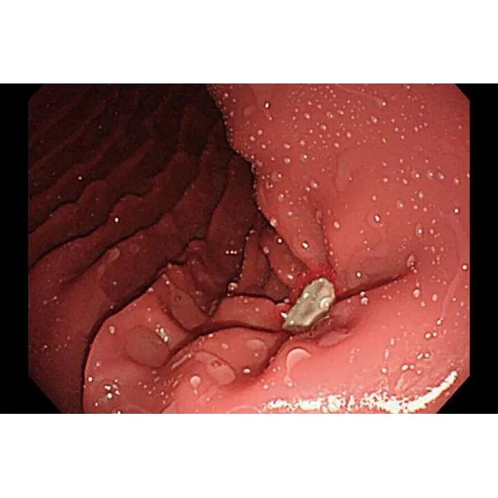Koken EGD (Esophago-Gastro-Duodenoscopy) Simulator