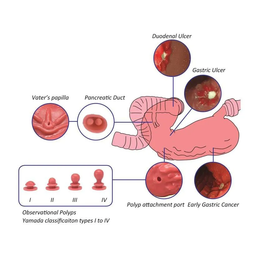 Koken EGD (Esophago-Gastro-Duodenoscopy) Simulator