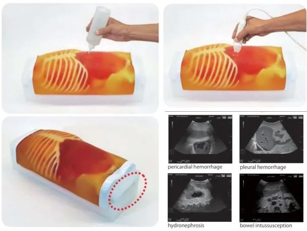 Pediatric FAST-Acute Abdomen Phantom