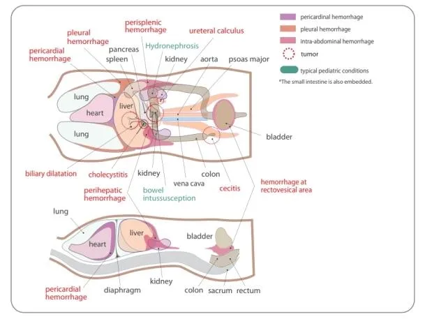Pediatric FAST-Acute Abdomen Phantom
