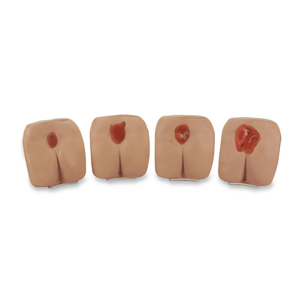 Pressure Ulcer-Bedsore Models, Light