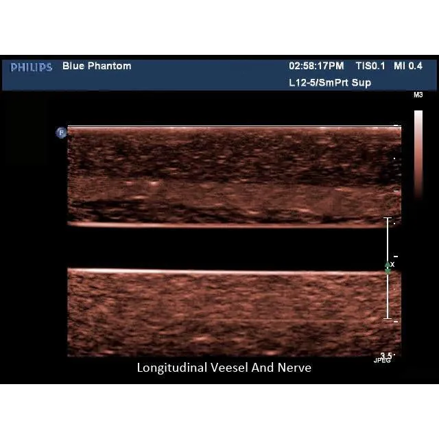 Regional Anesthesia Ultrasound Training Block