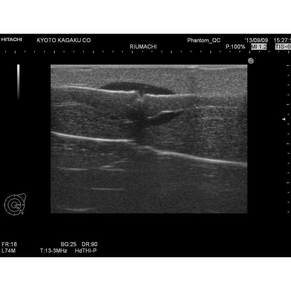 Rheumatoid Hand Phantom