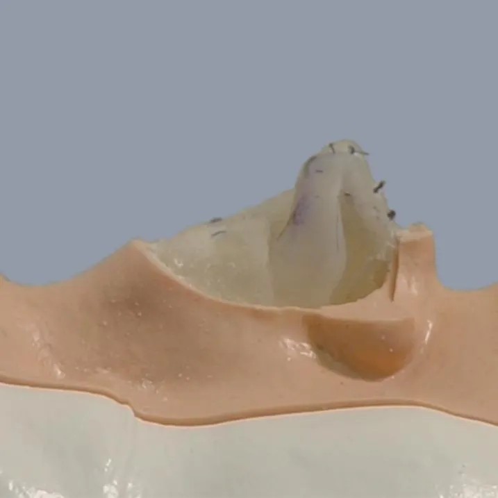 Rhinoplasty Surgical Training Simulator