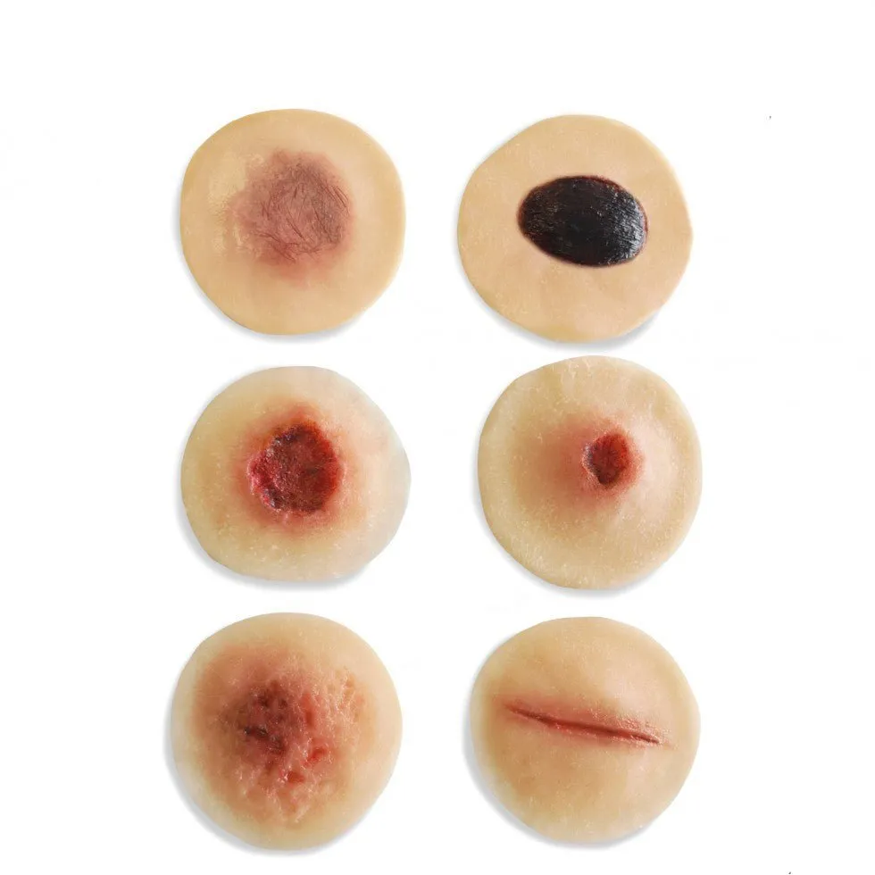 Set Of 6 Sticky Wounds