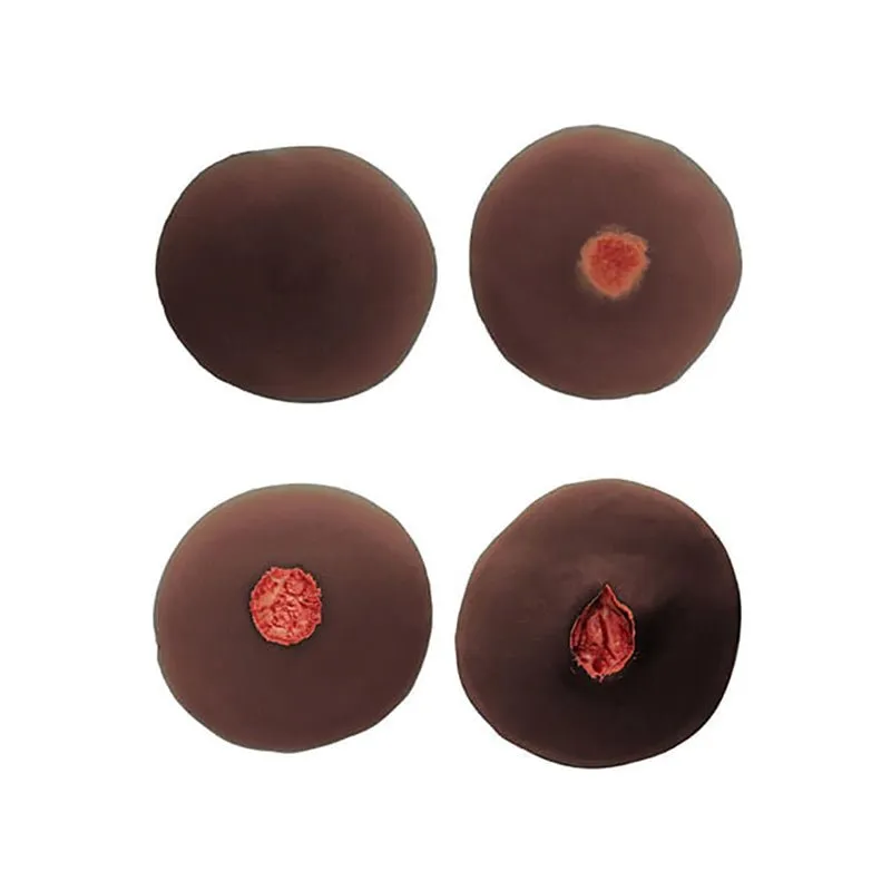 Sticky Evolutive Kit Of 4 Sinus Wounds