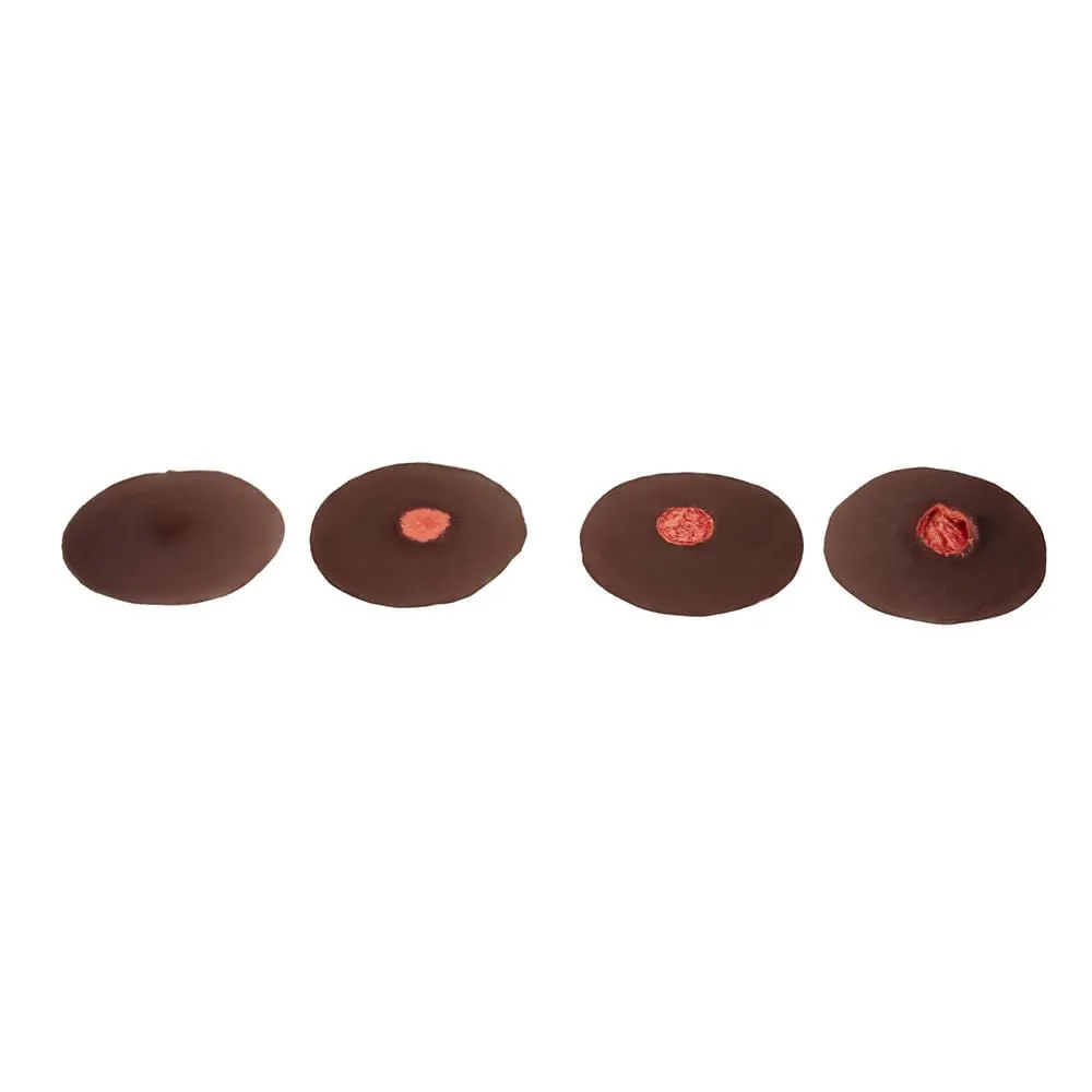 Sticky Evolutive Kit Of 4 Sinus Wounds