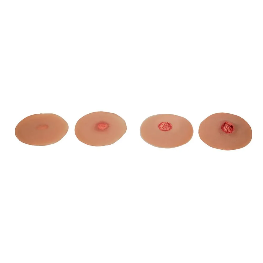 Sticky Evolutive Kit Of 4 Sinus Wounds