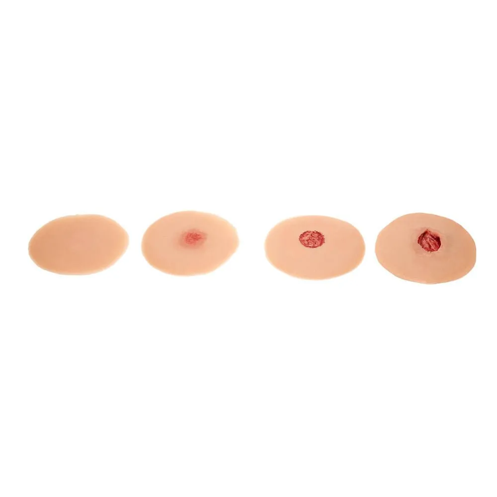 Sticky Evolutive Kit Of 4 Sinus Wounds