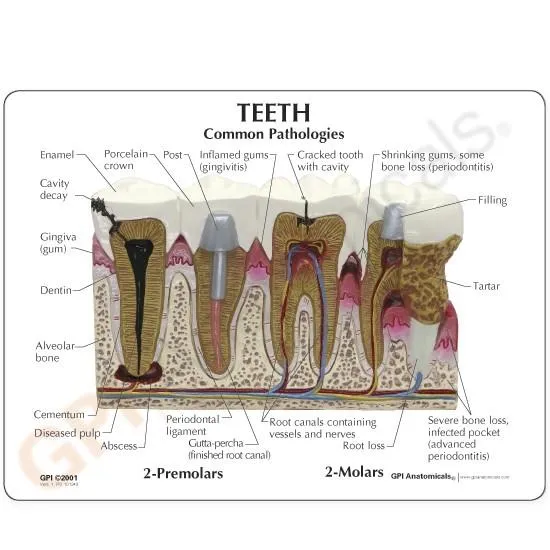 Teeth (oversize) Model