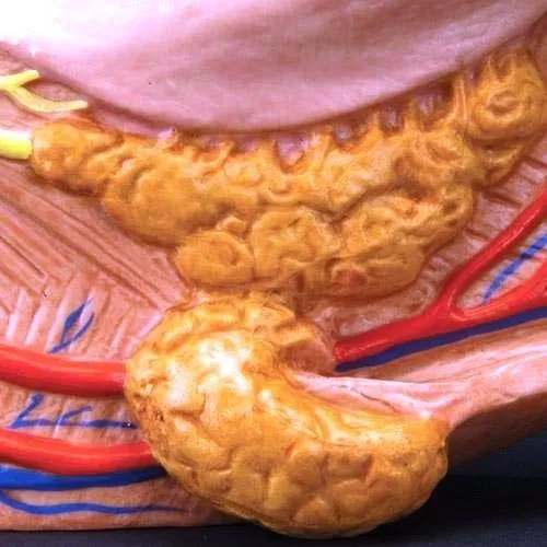 Tongue Model, 2.5 times life-size, 4-part