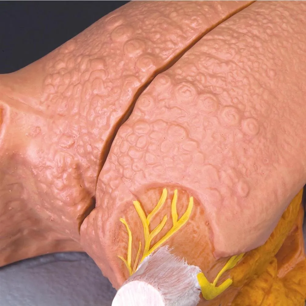 Tongue Model, 2.5 times life-size, 4-part