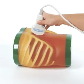 Ultrasound Exam 'ECHOZY' without Pathologies