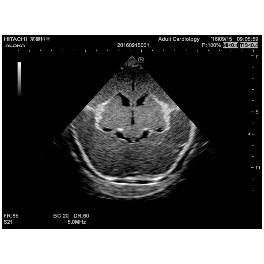 Ultrasound Neonatal Head Phantom, Normal type