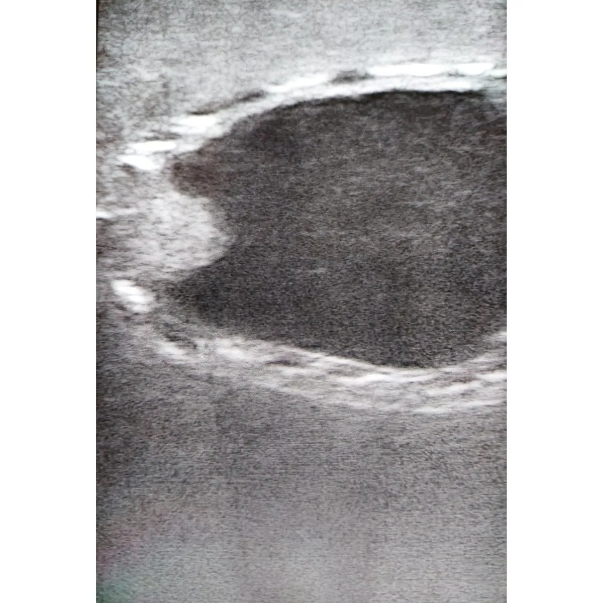 Ultrasound trainer dog bladder