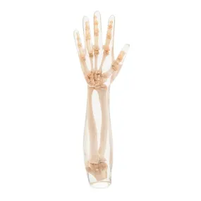 X-Ray Phantom Lower Arm, Transparent