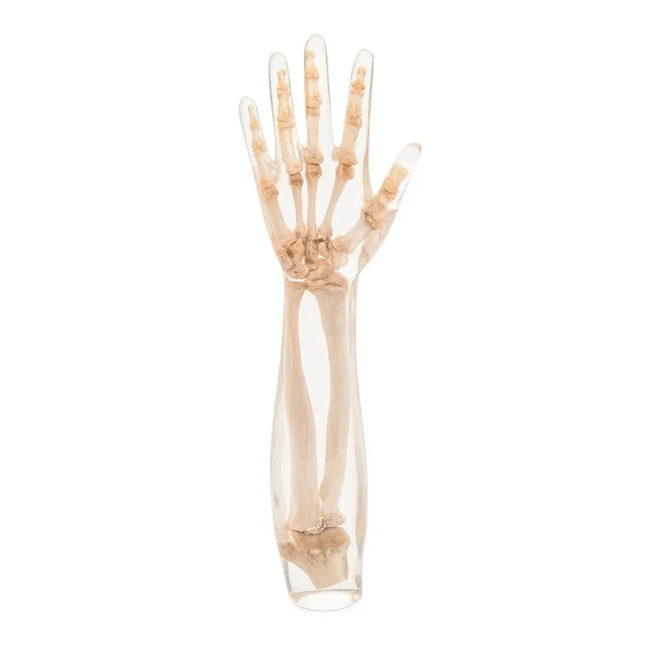 X-Ray Phantom Lower Arm, Transparent