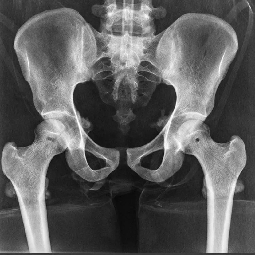 X-Ray Phantom Pelvis, Flexible